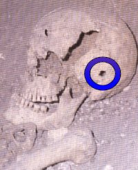Skull with ballista bolt hole
